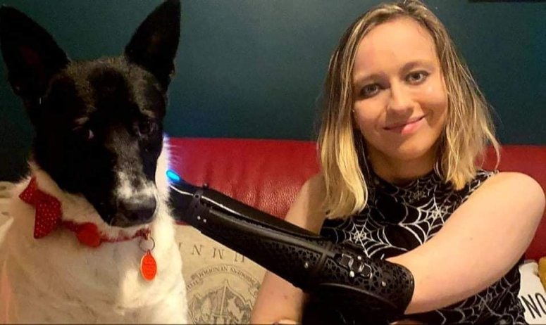 Wiki petting Tabi, her dog, with her bionic arm.